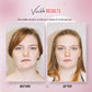 CareV™ EMSculpt Sleeping V-Face Beauty Device
